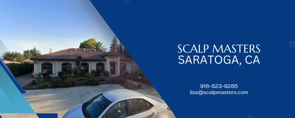 Scalp Micropigmentation in San Jose